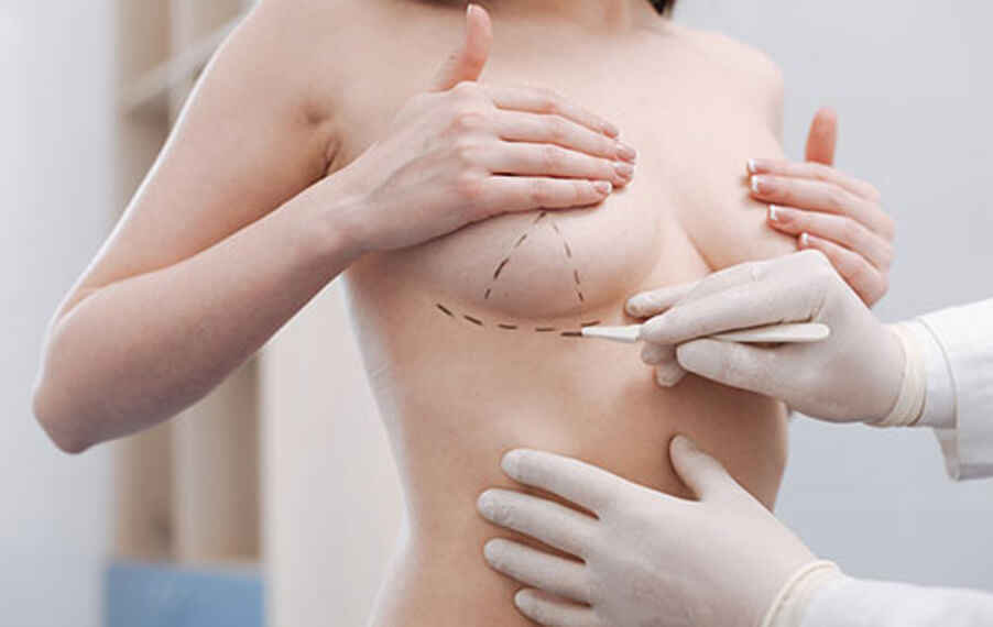 Phẫu thuật nâng ngực cũng là 1 phương pháp tăng kích thước vòng 1 dành cho các cô nàng 2 lưng, ngực lép